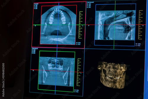 State-of-the-art surgery room at Elevation Center for Oral, Implant, and Facial Surgery equipped with advanced technology for precision treatments.
