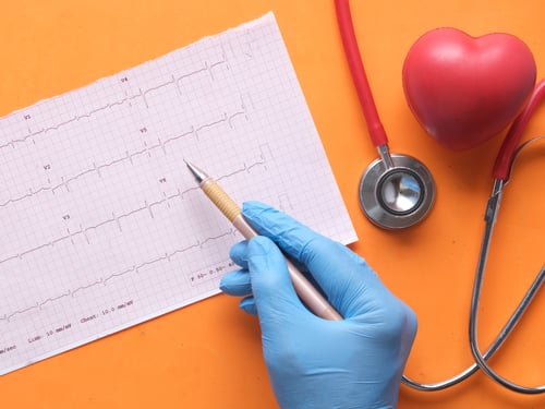 Image of medical chart and stethescope