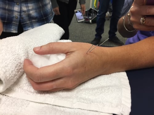 Hand Therapy for wrist and thumb pain