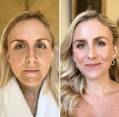 Intraceuticals Oxygen Facial