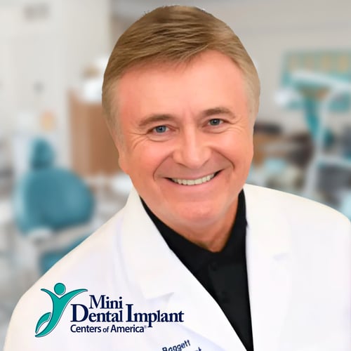 Mini Dental Implant Centers of America in Springfield, MO | Dr. Thomas Baggett, III
