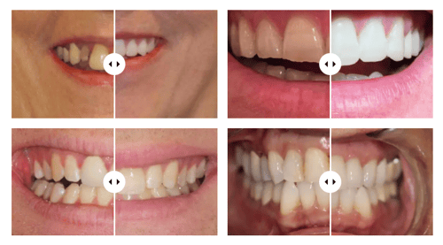 Dentist in Puyallup
MERIDIAN DENTAL CARE
16021 MERIDIAN E
PUYALLUP WA 98375
http://www.meridiandentalcare.com/