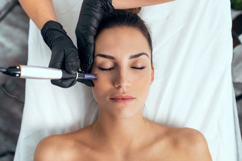 Radiofrequenz Microneedling