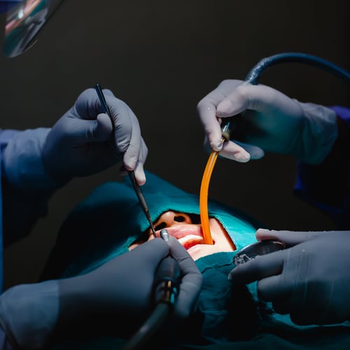 Step-by-step overview of maxillofacial surgery procedures for treating facial deformities and jaw misalignments.