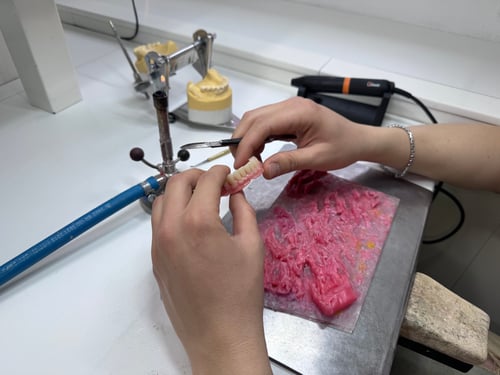 Fase di lavorazione di una protesi totale inferiore