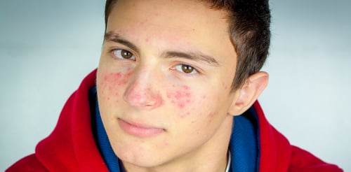 Cook Children's Dermatology patient