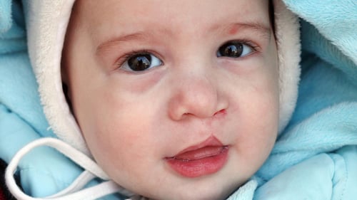 Cook Children's Pediatric Plastic Surgery