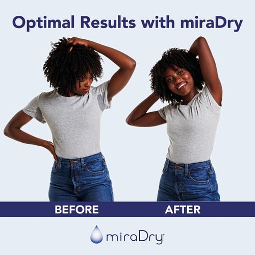 Miredry before and after