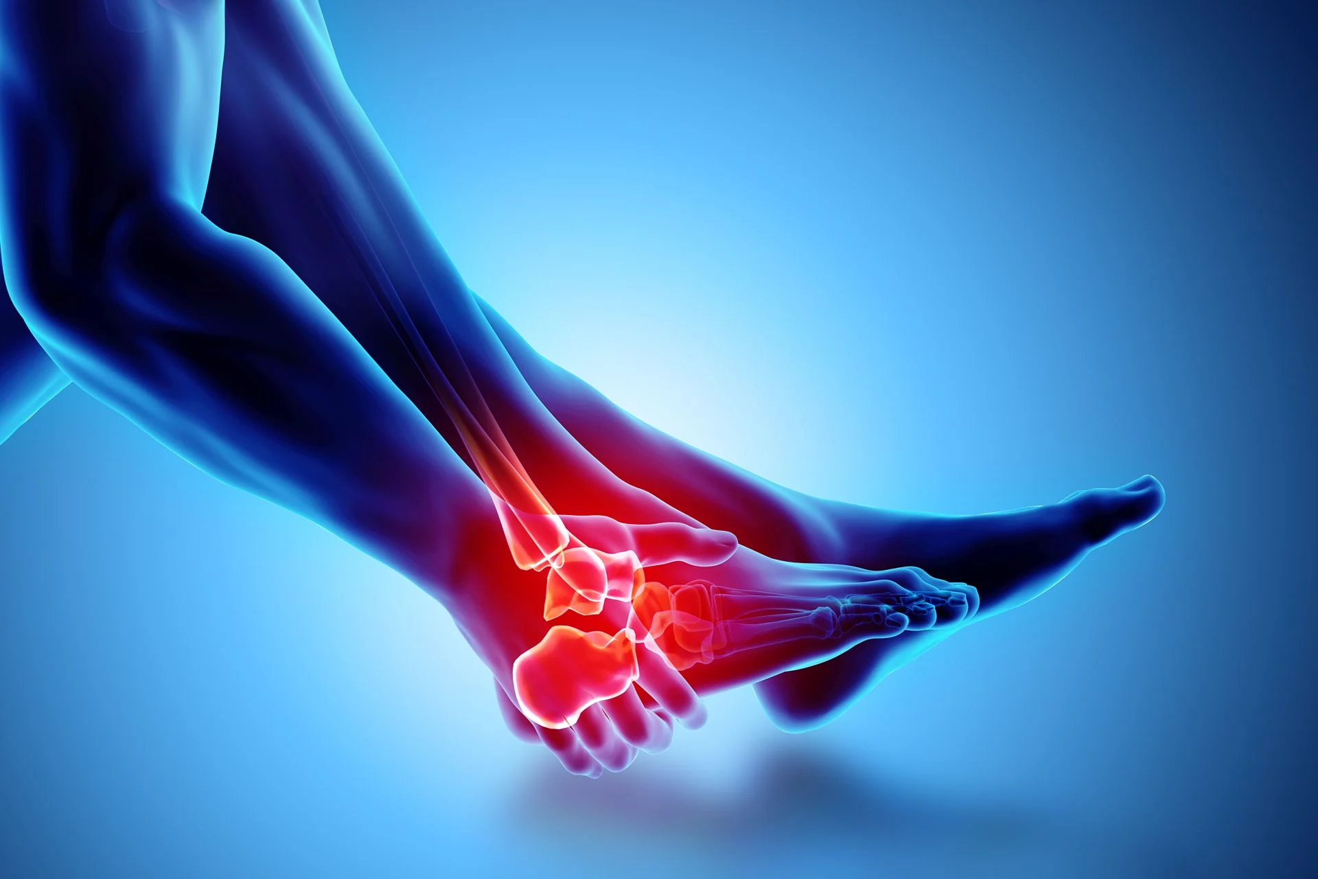 image showing internal plantar fasciitis during stretch