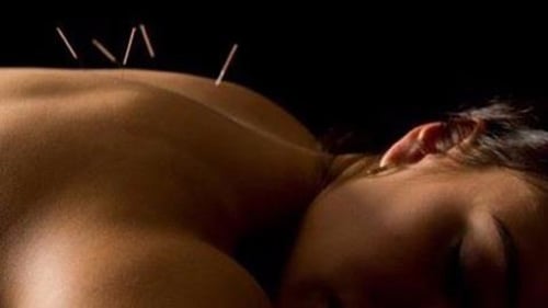 acupuncture treatment