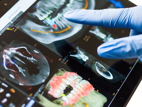 Image of dental xray