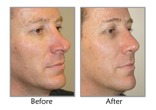 Utah Facial Plastics & UFP Aesthetics | Roy, UT