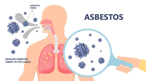 asbestos risk assessments