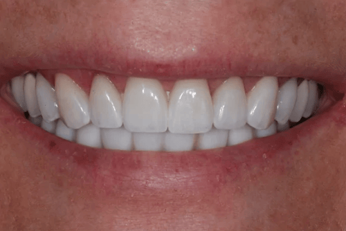 Dentist in Hutchinson
SAGE BRUSH DENTAL HEALTH
2901B N LORRAINE ST STE A
HUTCHINSON KS 67502
http://sagebrushdentalhealth.com/