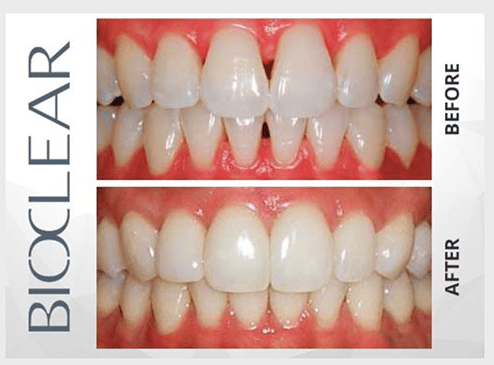 BELLS CORNERS DENTAL STUDIO
2150 ROBERTSON RD UNIT 9, NEPEAN, ON K2H 9S1, CANADA
http://www.bellscornersdentalstudio.com/