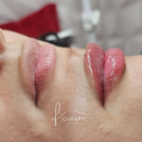 Specializing in facial rejuvenation, body contouring, laser hair removal, lymphatic drainage, and lip fillers med spa Brandon FL