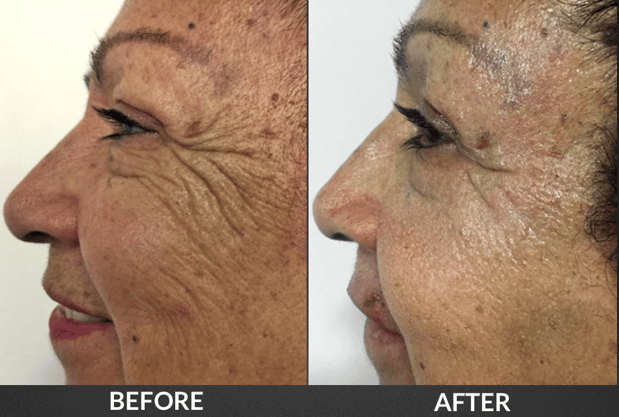 Images Health Now Med Spa