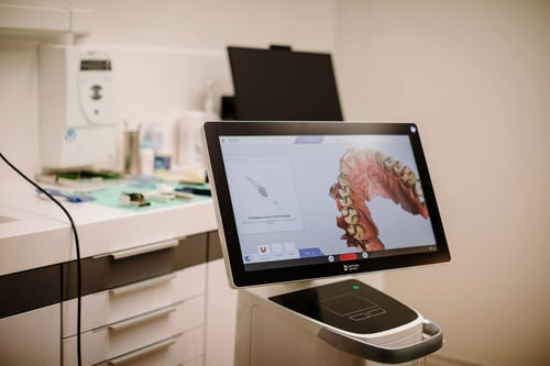 Modernster 3D-Scanner für digitale Zahnabdrücke – hochpräzise und ganz ohne unangenehmen Würgereiz.