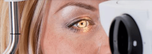 Optometrie
