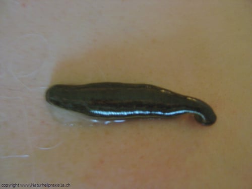 Medizinischer Blutegel - Hirudo medicinalis