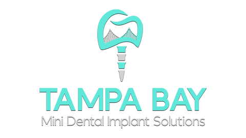 Mini Dental Implants in Tampa, FL | Luz Cabrera, DMD